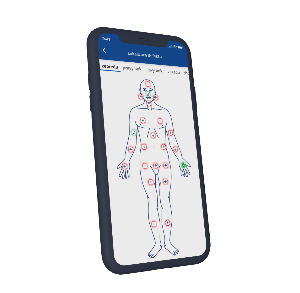 Assign to body part